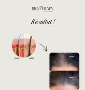 Pack Rituel Booster de pousse